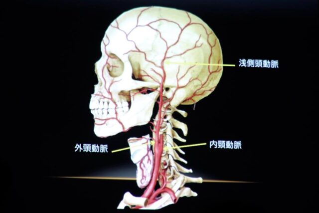 群発頭痛、子供の頭痛に効果あり！