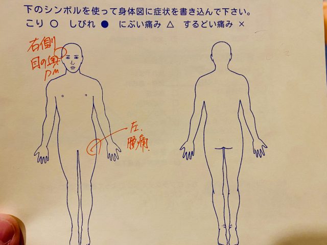 29歳　男性「右側の目の奥が痛い群発頭痛」症例