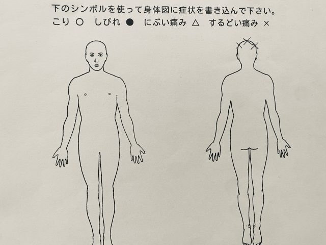 41歳　女性「頭痛、めまい、まっすぐ歩けない」症例