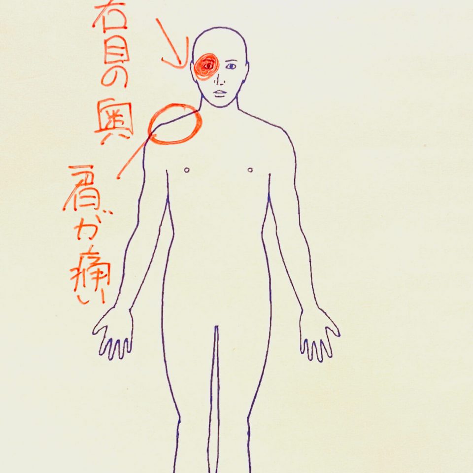 群発頭痛 右目の奥、肩が痛い
