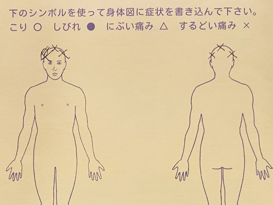 トンカチでたたかれてるような頭痛
