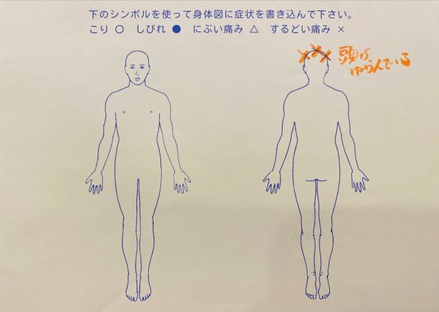 11歳　男性「小２からの偏頭痛」症例　2025.10.27
