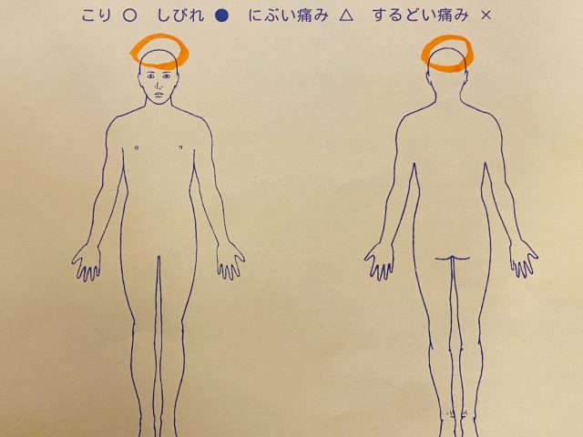 ７才　男性「７月頃から頭のぜんぶが痛い」症例　2025.12.17